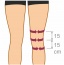 Ortza kolennho kloubu lebn, krtk, s jednoduchm kloubem ORTEX 04A (SKL:045000689) (foto 1)