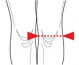 Ortza kolennho kloubu nvlekov se stabilizac pately OR 36 (SKL:04-5005885) (foto 1)