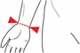 Ortza palce se dvma dlahami OR 10A/I (SKL:04-5005847) (foto 1)